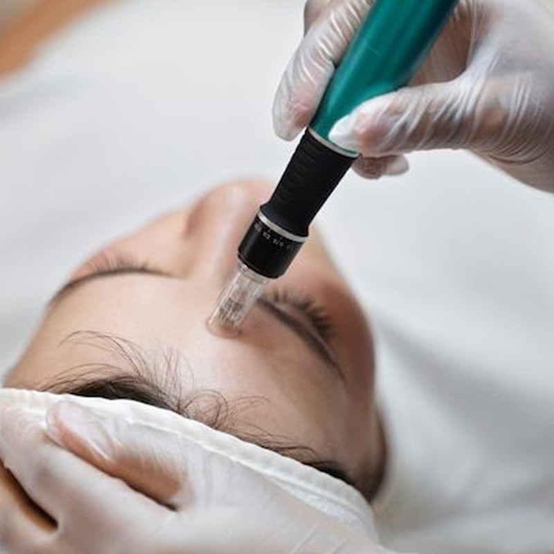 Skin-Remodeling 3D |  Pacchetto 5 sedute| Pharma Italia