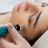 Microneedling