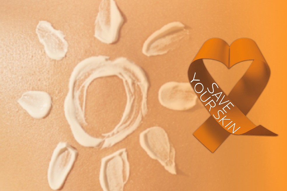 ☀️Maggio e Prevenzione Oncologica: Perché il Melanoma non aspetta l'Estate.