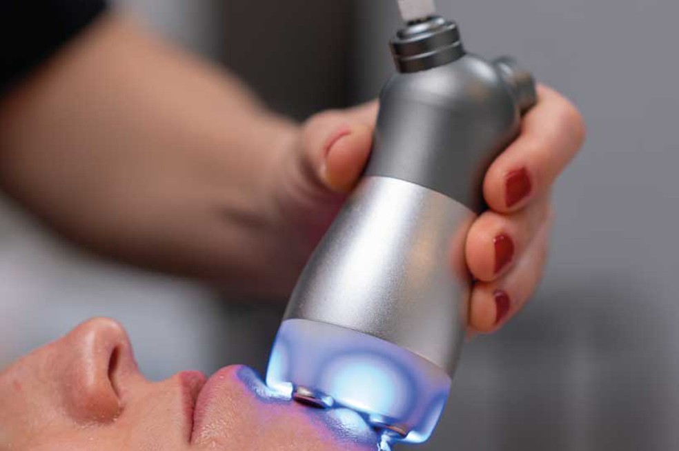 Elettroporazione Viso e Collo: La "Siringa Virtuale" senza Aghi del 2026